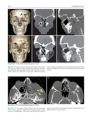 Publication- acknowledgement-AOMSI_Book- 1698.pdf