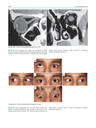 Publication- acknowledgement-AOMSI_Book- 1698.pdf