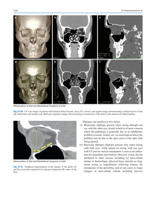 Publication- acknowledgement-AOMSI_Book- 1698.pdf