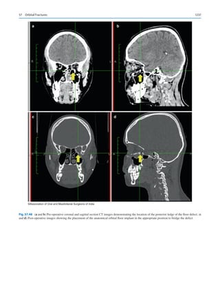 Publication- acknowledgement-AOMSI_Book- 1698.pdf
