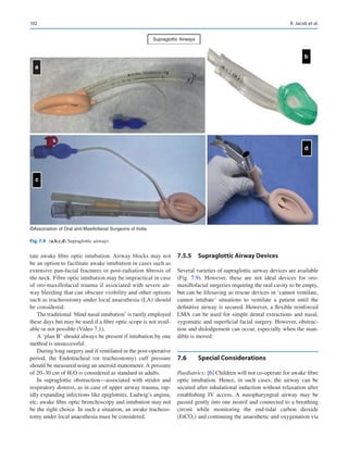 102
tate awake fibre optic intubation. Airway blocks may not
be an option to facilitate awake intubation in cases such as
extensive pan-facial fractures or post-­
radiation fibrosis of
the neck. Fibre optic intubation may be impractical in case
of oro-maxillofacial trauma if associated with severe air-
way bleeding that can obscure visibility and other options
such as tracheostomy under local anaesthesia (LA) should
be considered.
The traditional ‘blind nasal intubation’ is rarely employed
these days but may be used if a fibre optic scope is not avail-
able or not possible (Video 7.1).
A ‘plan B’ should always be present if intubation by one
method is unsuccessful.
During long surgery and if ventilated in the post-operative
period, the Endotracheal (or tracheostomy) cuff pressure
should be measured using an aneroid manometer. A pressure
of 20–30 cm of H2O is considered as standard in adults.
In supraglottic obstruction—associated with stridor and
respiratory distress, as in case of upper airway trauma, rap-
idly expanding infections like epiglottitis, Ludwig’s angina,
etc. awake fibre optic bronchoscopy and intubation may not
be the right choice. In such a situation, an awake tracheos-
tomy under local anaesthesia must be considered.
7.5.5	 
Supraglottic Airway Devices
Several varieties of supraglottic airway devices are available
(Fig.  7.9). However, these are not ideal devices for oro-­
maxillofacial surgeries requiring the oral cavity to be empty,
but can be lifesaving as rescue devices in ‘cannot ventilate,
cannot intubate’ situations to ventilate a patient until the
definitive airway is secured. However, a flexible reinforced
LMA can be used for simple dental extractions and nasal,
zygomatic and superficial facial surgery. However, obstruc-
tion and dislodgement can occur, especially when the man-
dible is moved.
7.6	 Special Considerations
Paediatrics: [6] Children will not co-operate for awake fibre
optic intubation. Hence, in such cases, the airway can be
secured after inhalational induction without relaxation after
establishing IV access. A nasopharyngeal airway may be
passed gently into one nostril and connected to a breathing
circuit while monitoring the end-tidal carbon dioxide
(EtCO2) and continuing the anaesthetic and oxygenation via
c
b
d
Supraglottic Airways
©Association of Oral and Maxillofacial Surgeons of India
a
Fig. 7.9 (a,b,c,d) Supraglottic airways
R. Jacob et al.
 