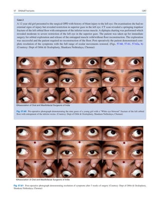 Publication- acknowledgement-AOMSI_Book- 1698.pdf