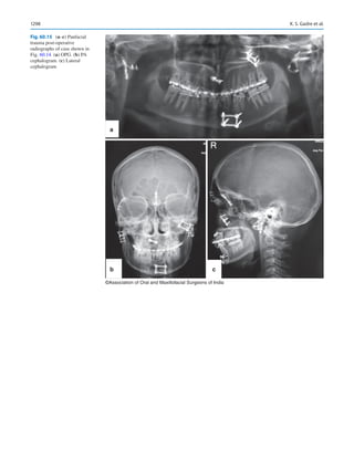 Publication- acknowledgement-AOMSI_Book- 1698.pdf
