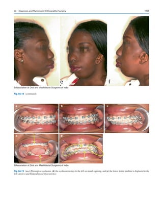 Publication- acknowledgement-AOMSI_Book- 1698.pdf