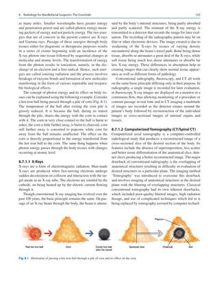 125
as many miles. Smaller wavelengths have greater energy
and penetration power and are called photon energy mean-
ing packets of energy and not particle energy. The two ener-
gies that are of concern in the present context are X-rays
and Gamma rays. Passage of these energies through body
tissues either for diagnostic or therapeutic purposes results
in a series of events beginning with an incidence of the
X-ray photon into tissue followed by sequential changes at
molecular and atomic levels. The transformation of energy
from the photon results in ionization, namely, in the dis-
charge of an electron and a free radical. Hence, such ener-
gies are called ionizing radiation and the process involves
breakage of enzyme bonds and formation of new molecules
manifesting in the form of various repairable and irrepara-
ble biological effects.
The concept of photon energy and its effect on body tis-
sues can be explained using the following example. Consider
a hot iron ball being passed through a pile of corn (Fig. 8.1).
The temperature of the ball after exiting the corn pile is
grossly reduced. It is because the ball, during its transit
through the pile, shares the energy with the corn in contact
with it. The corn in very close contact to the ball is burnt to
ashes, the corn a little farther away, is burnt to charcoal, corn
still further away is converted to popcorn, while corn far
away from the ball remains unaffected. The effect on the
corn is directly proportional to the energy transferred from
the hot iron ball to the corn. The same thing happens when
photon energy passes through the body tissues with changes
occurring at atomic level.
8.7.1.1	 X-Rays
X-rays are a form of electromagnetic radiation. Man-made
X-rays are produced when fast-moving electrons undergo
sudden deceleration on collision and interaction with the tar-
get anode in an X-ray tube. The electrons are emitted by the
cathode, on being heated up by the electric current flowing
through it.
Though conventional X-ray imaging has evolved over the
past 100 years, the basic principle remains the same. On pas-
sage of an X-ray beam through the body, the beam is attenu-
ated by the body’s internal structures, being partly absorbed
and partly scattered. The remnant of the X-ray energy is
transmitted to a detector that records the image for later eval-
uation. The recording of the radiographic pattern may be on
film or other electronic devices. The image created is due to
weakening of the X-rays by tissues of varying density
encountered along the beam’s travel path. Bone being dense
tissue, absorbs or attenuates a great deal of the X-rays, while
soft tissue being much less dense attenuates or absorbs far
less X-ray energy. These differences in absorption help in
creating images that can clearly show normal tissue appear-
ance as well as different forms of pathology.
Conventional radiography, fluoroscopy, and CT all work
on the same basic principle differing only in their purpose. In
radiography, a single image is recorded for later evaluation,
in fluoroscopy X-ray images are displayed on a monitor in a
continuous flow, thus allowing monitoring of a procedure or
contrast passage in real time and in CT imaging a multitude
of images are recorded as the detector rotates around the
patient’s body followed by reconstruction of the individual
images as cross-sectional images of internal organs and
tissues.
8.7.1.2	 
Computerized Tomography (CT/Spiral CT)
Computerized axial tomography is a computer-controlled
radiological study that produces a reconstructed image of a
cross-sectional slice of the desired section of the body. Its
features include the absence of superimposition, less scatter
and better tissue differentiation of the anatomical slice, thin-
ner slices producing a better reconstructed image. The major
drawback of conventional radiography is the overlapping of
anatomical structures resulting in difficulty in evaluation of
desired structures in a particular plane. The imaging method
‘Tomography’ was introduced to overcome this drawback
and involves imaging of anatomical structures at the desired
plane with the blurring of overlapping structures. Classical
conventional tomography had its own inherent drawbacks,
which included poor-quality blurred images, high radiation
dosage, and use of complicated techniques which led to it
being replaced by tomography assisted by computer technol-
Fig. 8.1  Illustration of passing a hot iron ball through a pile of corn and its effect on the corn
8  Radiology for Maxillofacial Surgeons: The Essentials
 