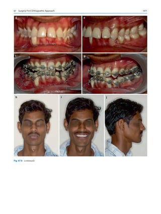 Publication- acknowledgement-AOMSI_Book- 1698.pdf