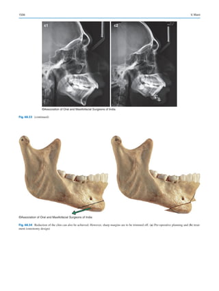 Publication- acknowledgement-AOMSI_Book- 1698.pdf