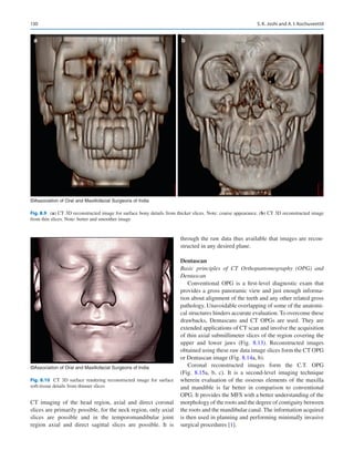 130
CT imaging of the head region, axial and direct coronal
slices are primarily possible, for the neck region, only axial
slices are possible and in the temporomandibular joint
region axial and direct sagittal slices are possible. It is
through the raw data thus available that images are recon-
structed in any desired plane.
Dentascan
Basic principles of CT Orthopantomography (OPG) and
Dentascan
Conventional OPG is a first-level diagnostic exam that
provides a gross panoramic view and just enough informa-
tion about alignment of the teeth and any other related gross
pathology. Unavoidable overlapping of some of the anatomi-
cal structures hinders accurate evaluation. To overcome these
drawbacks, Dentascans and CT OPGs are used. They are
extended applications of CT scan and involve the acquisition
of thin axial submillimeter slices of the region covering the
upper and lower jaws (Fig.  8.13). Reconstructed images
obtained using these raw data image slices form the CT OPG
or Dentascan image (Fig. 8.14a, b).
Coronal reconstructed images form the C.T.  OPG
(Fig.  8.15a, b, c). It is a second-level imaging technique
wherein evaluation of the osseous elements of the maxilla
and mandible is far better in comparison to conventional
OPG. It provides the MFS with a better understanding of the
morphology of the roots and the degree of contiguity between
the roots and the mandibular canal. The information acquired
is then used in planning and performing minimally invasive
surgical procedures [1].
a b
©Association of Oral and Maxillofacial Surgeons of India
Fig. 8.9 (a) CT 3D reconstructed image for surface bony details from thicker slices. Note: coarse appearance. (b) CT 3D reconstructed image
from thin slices. Note: better and smoother image
©Association of Oral and Maxillofacial Surgeons of India
Fig. 8.10  CT 3D surface rendering reconstructed image for surface
soft-tissue details from thinner slices
S. K. Joshi and A. I. Kochuveettil
 