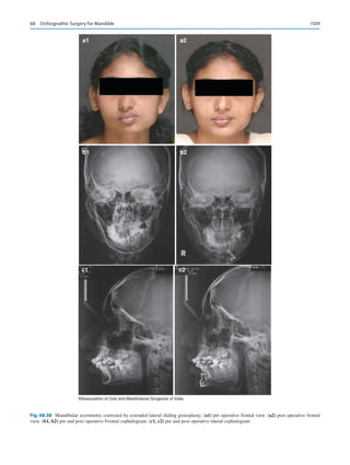 Publication- acknowledgement-AOMSI_Book- 1698.pdf