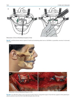 Publication- acknowledgement-AOMSI_Book- 1698.pdf