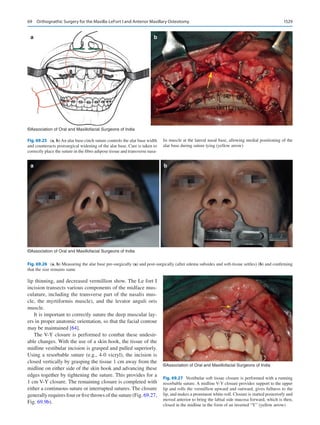 Publication- acknowledgement-AOMSI_Book- 1698.pdf