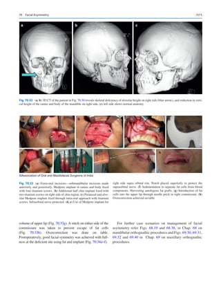 Publication- acknowledgement-AOMSI_Book- 1698.pdf