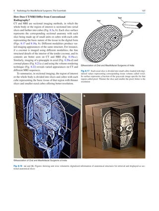 137
How Does CT/MRI Differ from Conventional
Radiography?
CT and MRI are sectional imaging methods, in which the
whole body or the region of interest is sectioned into serial
slices and further into cubes (Fig. 8.3a, b). Each slice surface
represents the corresponding sectional anatomy with each
slice being made up of small units or cubes with each cube
representing the basic nature of the tissue in the digital form
(Figs. 8.17 and 8.18a, b). Different modalities produce var-
ied imaging appearances of the same structure. For instance,
if a coconut is imaged using different modalities, the fine
structural details of the interior of the tender coconut, and its
contents are better seen on CT and MRI (Fig.  8.19a-c).
Similarly, imaging of a pineapple in axial (Fig. 8.20a-d) and
coronal planes (Fig. 8.21a-c) and using the volume-­rendering
technique (Fig. 8.22) reveals varied appearances on CT and
different MRI sequences.
To summarize, in sectional imaging, the region of interest
or the whole body is divided into slices and cubes with each
cube representing the basic tissue of that region with thinner
slices and smaller-sized cubes offering better resolution.
©Association of Oral and Maxillofacial Surgeons of India
Fig. 8.17  Each axial slice is divided into small cubes loaded with digi-
talized values representing corresponding tissue volume called voxel.
Its surface represents a fraction of the grayscale image specific for that
region called pixel. Thinner the slice and smaller the pixel, better is the
resolution
a b
©Association of Oral and Maxillofacial Surgeons of India
Fig. 8.18 (a) and (b). Figures showing unit wise volumetric digitalized information of anatomical structures for retrieval and displayed as sec-
tional anatomical slices
8  Radiology for Maxillofacial Surgeons: The Essentials
 