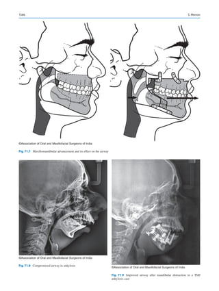Publication- acknowledgement-AOMSI_Book- 1698.pdf