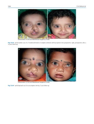 Publication- acknowledgement-AOMSI_Book- 1698.pdf