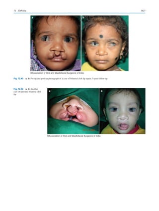 Publication- acknowledgement-AOMSI_Book- 1698.pdf