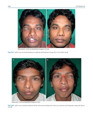 Publication- acknowledgement-AOMSI_Book- 1698.pdf