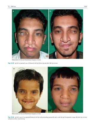 Publication- acknowledgement-AOMSI_Book- 1698.pdf