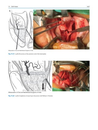 Publication- acknowledgement-AOMSI_Book- 1698.pdf
