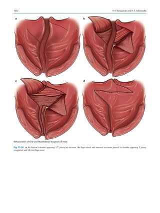 Publication- acknowledgement-AOMSI_Book- 1698.pdf