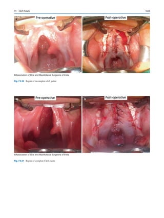 Publication- acknowledgement-AOMSI_Book- 1698.pdf