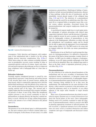 145
­
consequence. Early detection and diagnosis with readjust-
ment of the endotracheal tube is bound to be life saving,
helping prevent long-term complications (Fig.  8.29a–c).
Thick mucus plugs are other common occluding elements,
seen in postoperative recovery rooms resulting in lobar or
segmental opacities with loss of volume. Again, early detec-
tion and good respiratory physiotherapy are keys to improved
lung compliance with a radiograph taken at a later date as
follow-up.
Relaxation Atelectasis
Normally negative intrapleural pressure is caused by com-
peting thoracic pressures. Lung elasticity and surface tension
of the alveolar fluid create an inward tension, pulling the
lung inward, which is countered by opposing forces from the
pleural fluid and thoracic wall, the pleural cavity surface ten-
sion, and the parietal pleural attachment to the thoracic wall
causing outward pull of the lungs. The outward pull is
slightly higher than the inward pull with a negative intrapleu-
ral pressure of about -4 mm of Hg. When this intrapleural
negative pressure is lost as occurs commonly in cases of
pneumothorax or pleural effusion, the lung has a natural ten-
dency to recoil, with the loss of lung volume being propor-
tional to the amount of air or fluid collected in the pleural
space [11].
Pneumothorax
The presence of air in the pleural space is called pneumotho-
rax, the most common cause of which is trauma either acci-
dental or iatrogenic. In the absence of such causes, it is called
spontaneous pneumothorax. Radiological findings of pneu-
mothorax include increased peripheral translucency, absence
of lung markings within this area of translucency, and the
identifiable visceral pleural margin of the collapsed lung
(Figs.  8.30 and 8.31). The detection of a pneumothorax
should prompt the search for an underlying cause like a frac-
tured rib or a ruptured bulla or iatrogenic causes like a cen-
tral venous catheter procedure. Associated lesions like
pneumomediastinum and surgical emphysema should also
be looked for.
A maxillofacial surgeon might have to read supine porta-
ble radiographs of patients presenting with clinical signs
suggesting respiratory distress and the presence of pneumo-
thorax might be missed. In such a scenario, the MFS should
look for radiographic evidence of pneumothorax at sites
adjacent to the diaphragmatic silhouettes on either side and
the cardiophrenic and costophrenic angles and he should
also be able to appreciate the appearance of an exceptionally
sharp cardiac border [11]. The MFS needs to be aware that
air trapped within the skin folds can mimic pneumothorax
(Fig. 8.32).
Identification of an air fluid level would prompt the diag-
nosis of a hydropneumothorax. It is difficult to characterize
the nature of the fluid as being transudate, exudate, blood, or
chylous. An MFS may be unable to diagnose a hydropneu-
mothorax, on an AP supine portable radiograph as the fluid
level will not be identified. Here, the collapsed lung tends to
float on the fluid, which is dependent posteriorly giving a
veil effect (Fig. 8.33).
Pneumomediastinum
It is the collection of air within the pleural boundaries of the
mediastinum and can arise secondary to barotrauma from
mechanical trauma, intrathoracic, or iatrogenic trauma and
infection or can occur spontaneously.A radiographic diagno-
sis of pneumomediastinum requires depiction of normal ana-
tomic structures being outlined by air as they leave the
mediastinum. The mediastinal air can cause elevation of the
thymus, collect anterior or posterior to the pericardium, sur-
round the pulmonary artery or its branches, or can collect
adjacent to the major aortic branches or major bronchi
(Fig. 8.34).
Most cases of pneumomediastinum described in maxil-
lofacial surgery literature are as a result of dissection of air
down the fascial planes of the neck. Chest radiographic
findings need to be carefully examined to make the diag-
nosis of pneumomediastinum, which is crucial to the MFS
in planning appropriate treatment of affected patients. On
rare occasions, a significant amount of air in the mediasti-
num can cause vessel or tracheal obstruction and induce
symptoms and signs of tamponade and decreased venous
return.
©Association of Oral and Maxillofacial Surgeons of India
Fig. 8.28  Aspiration Bronchopneumonia
8  Radiology for Maxillofacial Surgeons: The Essentials
 
