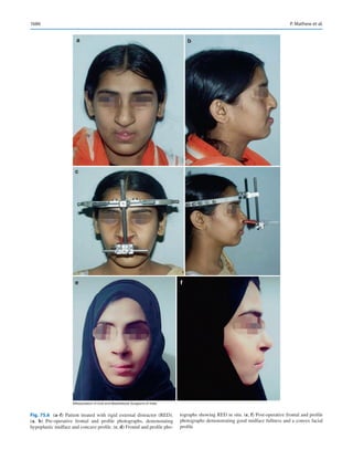 Publication- acknowledgement-AOMSI_Book- 1698.pdf