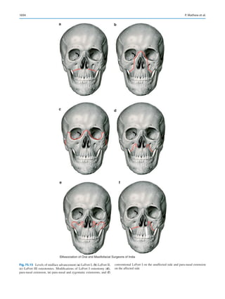Publication- acknowledgement-AOMSI_Book- 1698.pdf