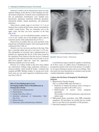149
Pulmonary nodules can be characterized, based on some
signature findings. In the absence of these findings, the nod-
ule remains nonspecific. Common causes of pulmonary nod-
ules are granulomas, bronchogenic cysts, hydatid cysts,
hamartomas, pulmonary hematoma following laceration,
rheumatoid nodules, fungal granulomas, and pulmonary
metastasis.
Tuberculomas usually range in size from 1 to 3  cm in
diameter, have central calcific lesions, and are surrounded by
satellite scarred lesions. They are commonly seen in the
upper zones, but they can occur anywhere in the lung
(Fig. 8.36).
Bronchogenic cysts are well-defined nodules, around 3 to
4 cm in size, usually seen in the parahilar region, and are
sometimes purely in the mediastinum (Fig. 8.37a–e).
Hamartomas are nodules that can occur anywhere in the
lung having well-defined margins with central popcorn-like
calcification (Fig. 8.38a, b).
Hydatid cysts, too, can occur anywhere in the lung. They
have a stenciled outline and vary in size from 1 to 10 cms.
The radiographic air crescentic sign is pathognomonic of a
hydatid cyst, appearing like the arc of the moon caused by
the separation of the endocyst from the exocyst. Continued
separation of the endocyst from the exocyst results in an air
fluid level typically called the ‘water lily’ appearance.
Pulmonary hydatid cysts do not calcify.
Presence of a solitary nodule in the lower lung without
any characteristic findings makes pulmonary metastasis a
strong possibility, which should be further evaluated with
imaging and HPR. Multiple nodules of varying sizes in the
lower zones are very much suggestive of pulmonary metas-
tasis.(Fig. 8.39a, b).
A maxillofacial surgeon should be capable of identifying
all of these causes of sudden onset of breathlessness in a
postoperative patient in the event of the absence of availabil-
ity of expert radiological opinion and act accordingly. They
also need to be aware that patients on ventilators may develop
ventilator-dependent complications.
A glance into the future of imaging for Maxillofacial
Surgeons
	1.	 Magnetization Transfer Imaging
This is a modified MRI study that helps in
•	 Prediction of whether the primary tumor is benign or
malignant (possible in 80 to 90% cases).
•	 Differentiation of reactive versus malignant
adenopathy.
This modality is still in the preliminary stage and needs
further study.
	
2.	MRI-guided biopsy procedures need MRI compatible
equipment. The procedures are feasible and are usually
done in cases that are not amenable to USG guidance.
	
3.	 Functional imaging of swallowing.
©Association of Oral and Maxillofacial Surgeons of India
Fig. 8.36  Pulmonary Nodule—Tuberculoma
Role of Chest Radiograph in Cases
Developing Sudden Onset of Breathlessness in
Postoperative Period
	1.	 Aspiration Bronchopneumonia
	2.	 Pneumothorax
	
3.	 Foreign body (Fig. 8.40a–c)
	
4.	
Abnormal placement of Endotracheal Tube
(Fig. 8.41)
	5.	 Pleural effusion
	
6.	 Pulmonary edema and pulmonary embolism
8  Radiology for Maxillofacial Surgeons: The Essentials
 
