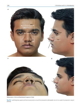 Publication- acknowledgement-AOMSI_Book- 1698.pdf