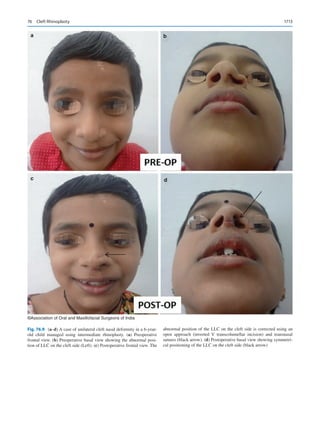 Publication- acknowledgement-AOMSI_Book- 1698.pdf