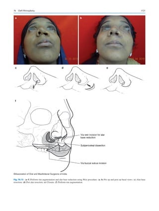 Publication- acknowledgement-AOMSI_Book- 1698.pdf