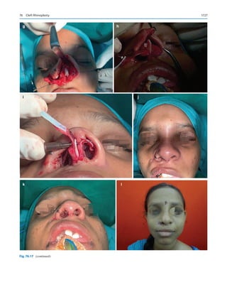 Publication- acknowledgement-AOMSI_Book- 1698.pdf