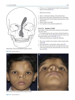 Publication- acknowledgement-AOMSI_Book- 1698.pdf