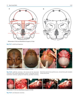 Publication- acknowledgement-AOMSI_Book- 1698.pdf