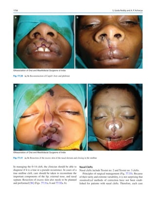 Publication- acknowledgement-AOMSI_Book- 1698.pdf