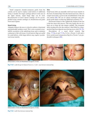 Publication- acknowledgement-AOMSI_Book- 1698.pdf
