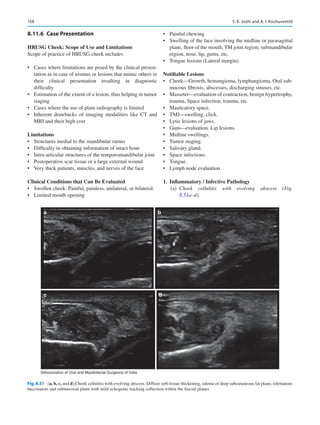 158
8.11.6	 Case Presentation
HRUSG Cheek: Scope of Use and Limitations
Scope of practice of HRUSG cheek includes
•	 Cases where limitations are posed by the clinical presen-
tation as in case of trismus or lesions that mimic others in
their clinical presentation resulting in diagnostic
difficulty
•	 Estimation of the extent of a lesion, thus helping in tumor
staging
•	 Cases where the use of plain radiography is limited
•	 Inherent drawbacks of imaging modalities like CT and
MRI and their high cost
Limitations
•	 Structures medial to the mandibular ramus
•	 Difficulty in obtaining information of intact bone
•	 Intra-articular structures of the temporomandibular joint
•	 Postoperative scar tissue or a large external wound
•	 Very thick patients, muscles, and nerves of the face
Clinical Conditions that Can Be Evaluated
•	 Swollen cheek: Painful, painless, unilateral, or bilateral.
•	 Limited mouth opening
•	 Painful chewing
•	 Swelling of the face involving the midline or parasagittal
plane, floor of the mouth, TM joint region, submandibular
region, nose, lip, gums, etc.
•	 Tongue lesions (Lateral margin).
Notifiable Lesions
•	 Cheek—Growth, hemangioma, lymphangioma, Oral sub-
mucous fibrosis, abscesses, discharging sinuses, etc.
•	 Masseter—evaluation of contraction, benign hypertrophy,
trauma, Space infection, trauma, etc.
•	 Masticatory space.
•	 TMJ—swelling, click.
•	 Lytic lesions of jaws.
•	 Gum—evaluation. Lip lesions.
•	 Midline swellings.
•	 Tumor staging.
•	 Salivary gland.
•	 Space infections.
•	 Tongue.
•	 Lymph node evaluation.
	
1.	 Inflammatory / Infective Pathology
	(a)	
Cheek cellulitis with evolving abscess (Fig.
8.51a–d).
a
c d
b
©Association of Oral and Maxillofacial Surgeons of India
Fig. 8.51 (a, b, c, and d).Cheek cellulitis with evolving abscess. Diffuse soft-tissue thickening, edema of deep subcutaneous fat plane, edematous
buccinators and submucosal plane with mild echogenic tracking collection within the fascial planes
S. K. Joshi and A. I. Kochuveettil
 
