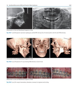 Publication- acknowledgement-AOMSI_Book- 1698.pdf