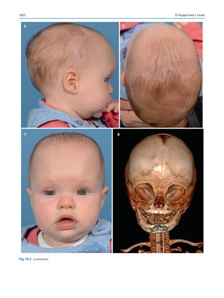 Publication- acknowledgement-AOMSI_Book- 1698.pdf