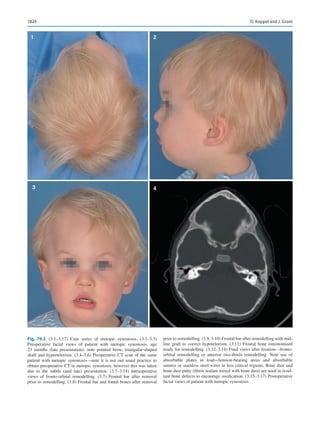 Publication- acknowledgement-AOMSI_Book- 1698.pdf