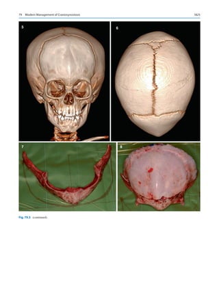 Publication- acknowledgement-AOMSI_Book- 1698.pdf