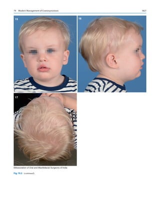 Publication- acknowledgement-AOMSI_Book- 1698.pdf