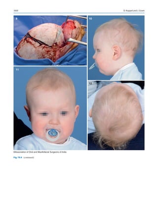 Publication- acknowledgement-AOMSI_Book- 1698.pdf