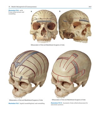 Publication- acknowledgement-AOMSI_Book- 1698.pdf