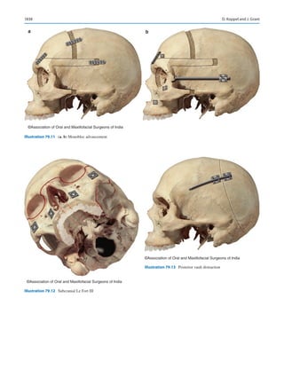 Publication- acknowledgement-AOMSI_Book- 1698.pdf
