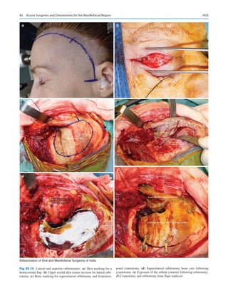Publication- acknowledgement-AOMSI_Book- 1698.pdf