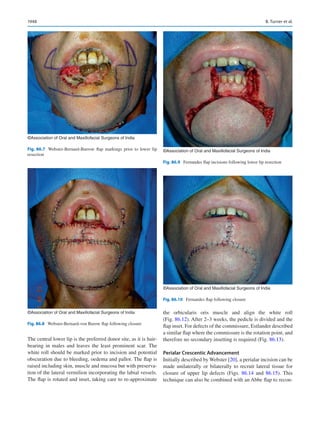 Publication- acknowledgement-AOMSI_Book- 1698.pdf