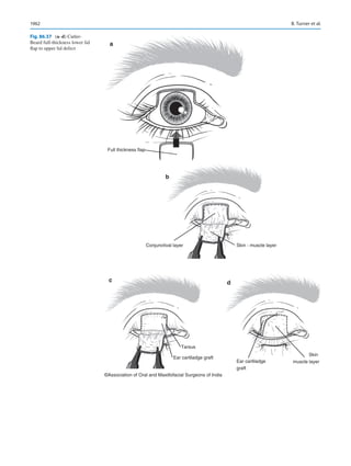 Publication- acknowledgement-AOMSI_Book- 1698.pdf