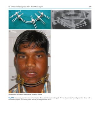 Publication- acknowledgement-AOMSI_Book- 1698.pdf